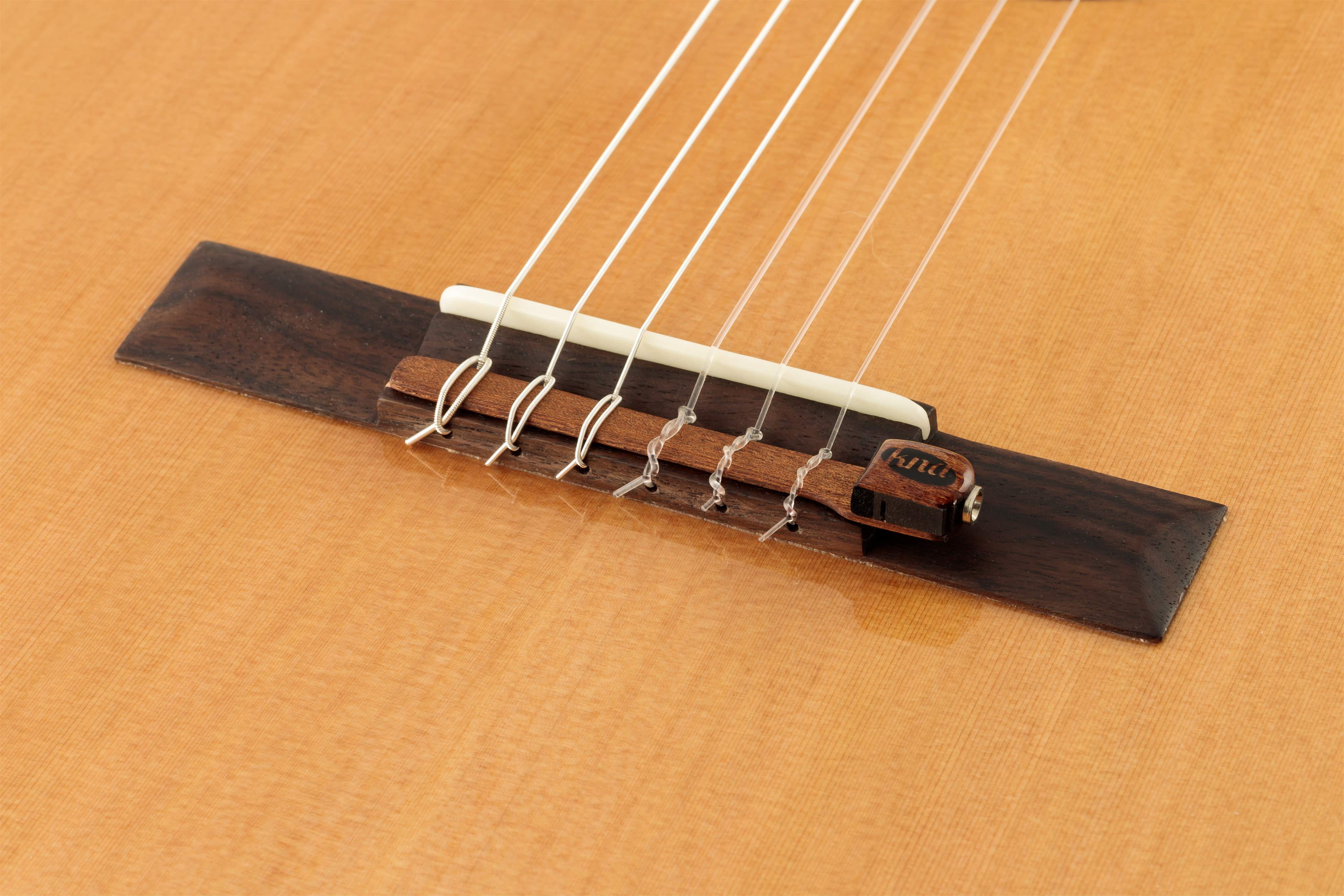 KNA PICKUPS NG-1